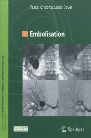 couverture embolisation