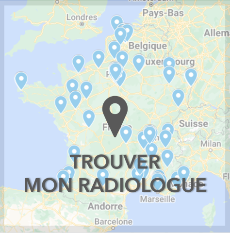 SFICV map